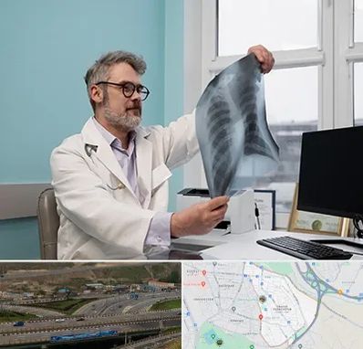 دکتر سرطان مغز و استخوان در یاغچیان تبریز