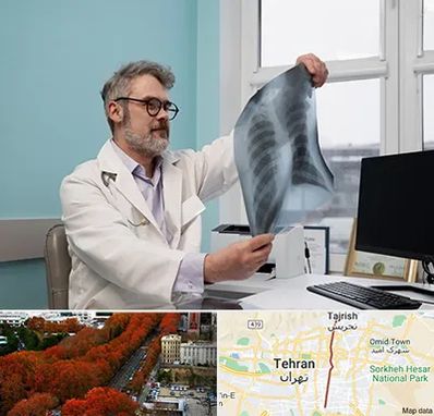 دکتر سرطان مغز و استخوان در ولیعصر 