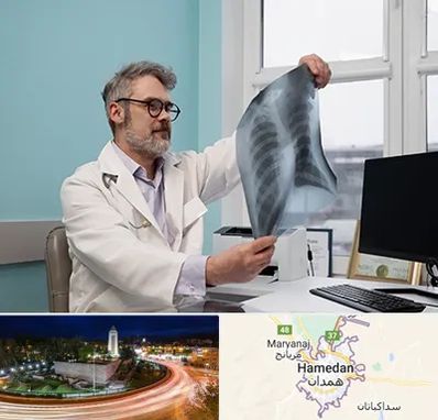 دکتر سرطان مغز و استخوان در همدان