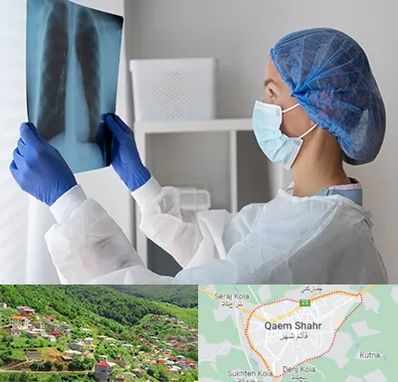 جراح سرطان مغز و استخوان در قائم شهر