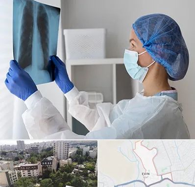 جراح سرطان مغز و استخوان در اوین