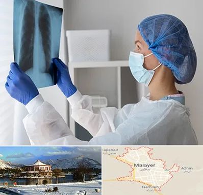 جراح سرطان مغز و استخوان در ملایر