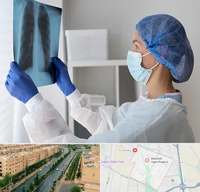 جراح سرطان مغز و استخوان در فاز سه اندیشه