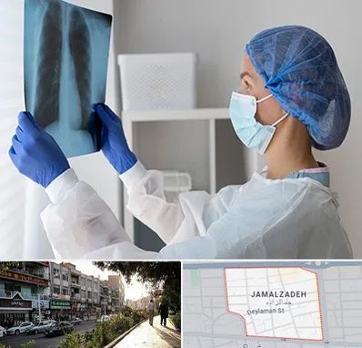 جراح سرطان مغز و استخوان در خیابان جمالزاده