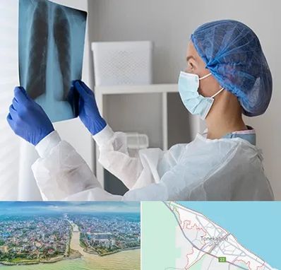 جراح سرطان مغز و استخوان در تنکابن