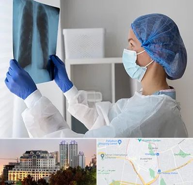 جراح سرطان مغز و استخوان در فرشته 