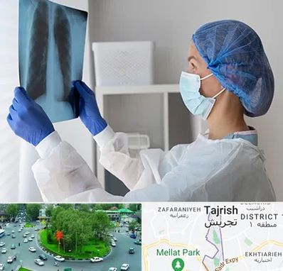 جراح سرطان مغز و استخوان در تجریش 