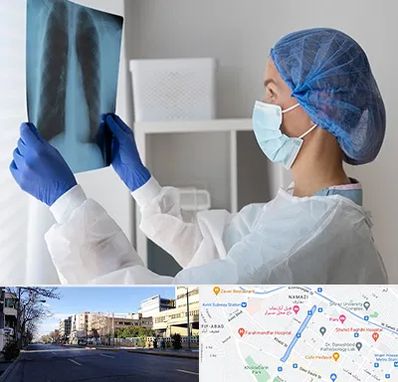 جراح سرطان مغز و استخوان در خیابان ملاصدرا شیراز 