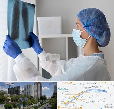 جراح سرطان مغز و استخوان در اندرزگو 