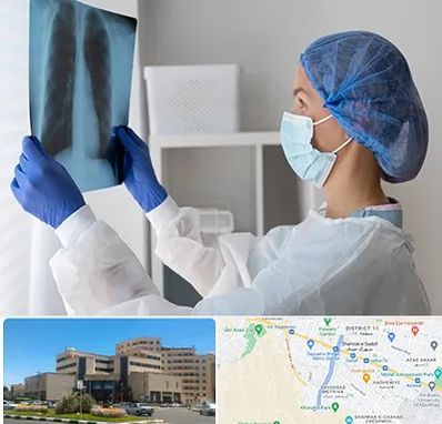 جراح سرطان مغز و استخوان در صیاد شیرازی مشهد 