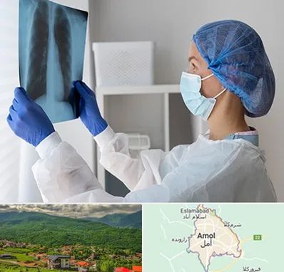 جراح سرطان مغز و استخوان در آمل