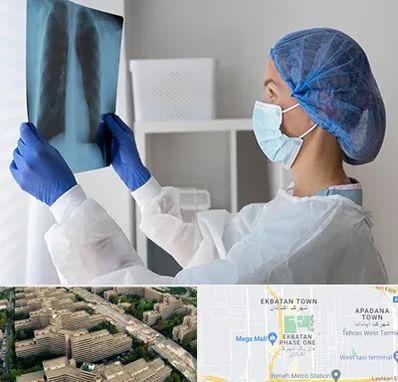 جراح سرطان مغز و استخوان در اکباتان 