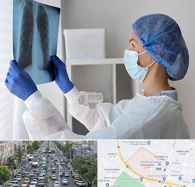 جراح سرطان مغز و استخوان در گلشهر کرج 