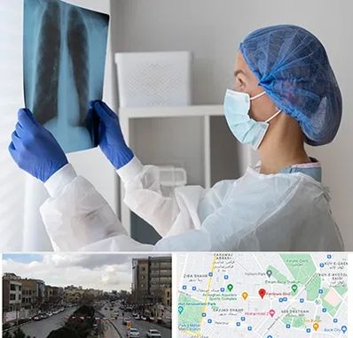 جراح سرطان مغز و استخوان در بلوار فردوسی مشهد 