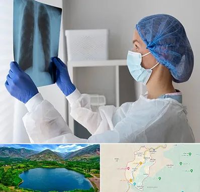 جراح سرطان مغز و استخوان در رودبار