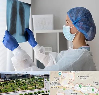 جراح سرطان مغز و استخوان در پردیس