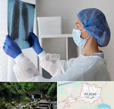 جراح سرطان مغز و استخوان در علی آباد کتول