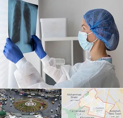 جراح سرطان مغز و استخوان در فردیس کرج 