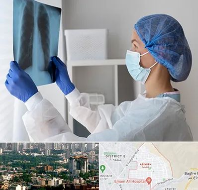 جراح سرطان مغز و استخوان در عظیمیه کرج 