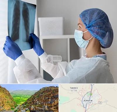 جراح سرطان مغز و استخوان در کامیاران