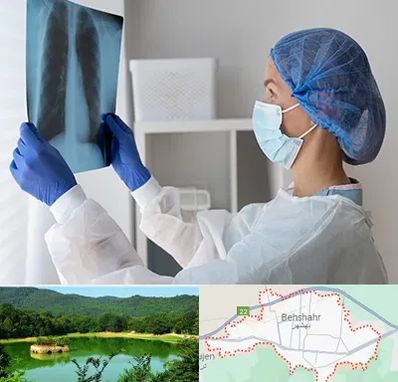 جراح سرطان مغز و استخوان در بهشهر