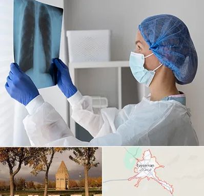 جراح سرطان مغز و استخوان در تویسرکان