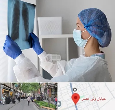 جراح سرطان مغز و استخوان در ولیعصر شهریار