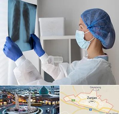 جراح سرطان مغز و استخوان در زنجان