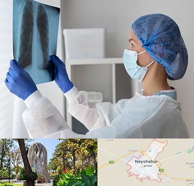 جراح سرطان مغز و استخوان در نیشابور