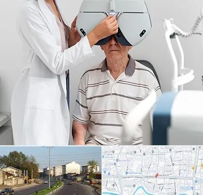 دکتر سرطان چشم در ضیابری رشت 