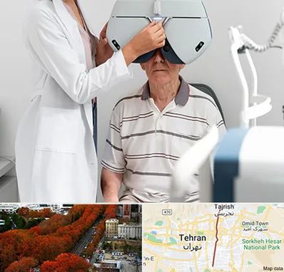 دکتر سرطان چشم در ولیعصر 