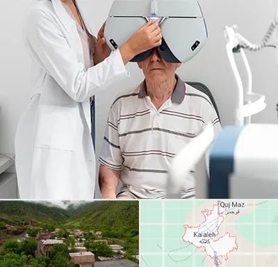 دکتر سرطان چشم در کلاله