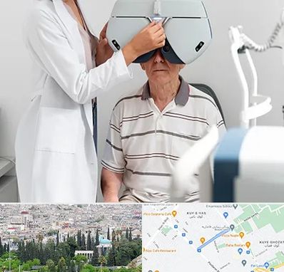 دکتر سرطان چشم در محلاتی شیراز 