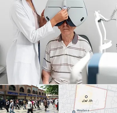 دکتر سرطان چشم در بازار تهران