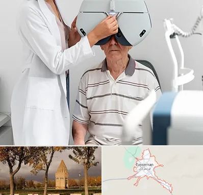 دکتر سرطان چشم در تویسرکان
