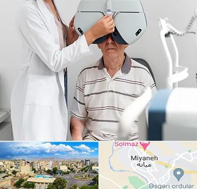 دکتر سرطان چشم در میانه