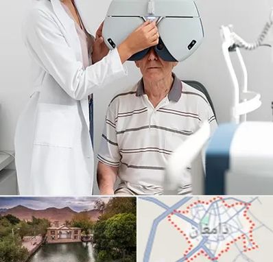 دکتر سرطان چشم در دامغان