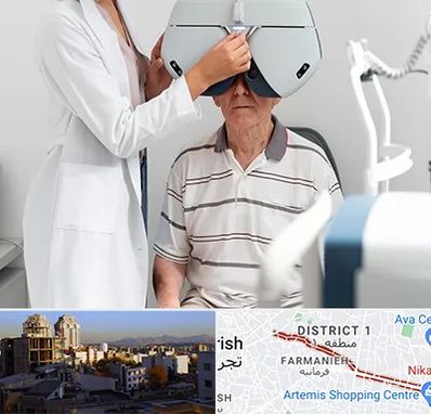 دکتر سرطان چشم در فرمانیه 