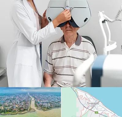 دکتر سرطان چشم در تنکابن