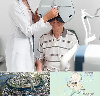 دکتر سرطان چشم در بابل