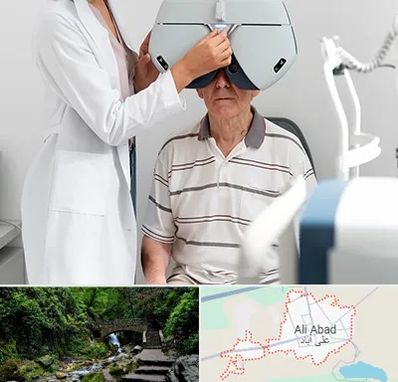 دکتر سرطان چشم در علی آباد کتول