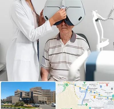 دکتر سرطان چشم در صیاد شیرازی مشهد 