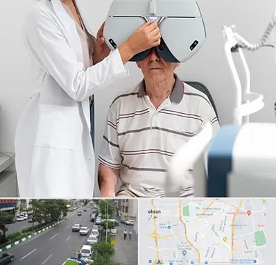 دکتر سرطان چشم در ستارخان 