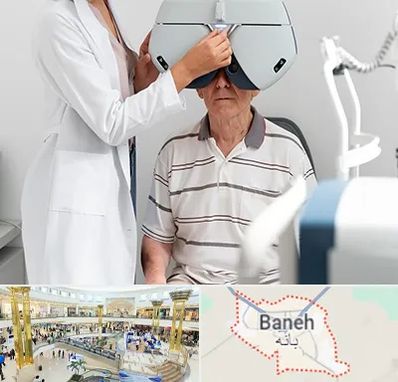 دکتر سرطان چشم در بانه