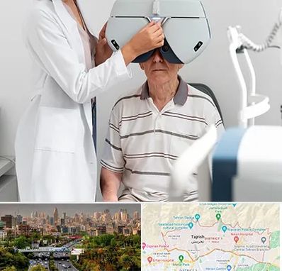 دکتر سرطان چشم در منطقه 1 تهران 