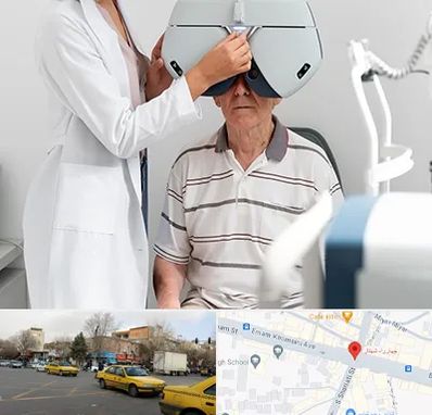 دکتر سرطان چشم در شهناز تبریز