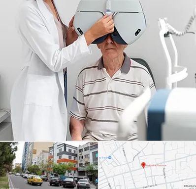 دکتر سرطان چشم در هفده شهریور تبریز