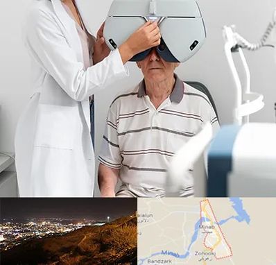 دکتر سرطان چشم در میناب