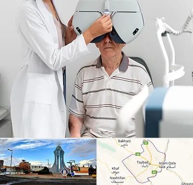 دکتر سرطان چشم در تایباد
