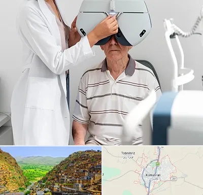 دکتر سرطان چشم در کامیاران